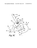 GOLF CLUB HEAD diagram and image