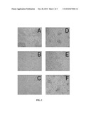 WATER-SOLUBLE POLYMER-BASED CANTHARIMIDES AS POTENTIALLY SELECTIVE ANTI-TUMOR AGENTS diagram and image