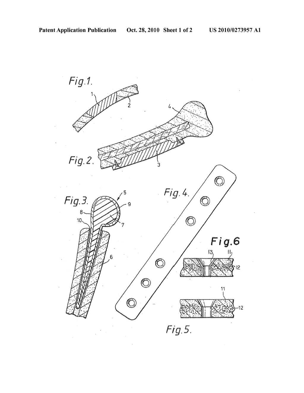 Prosthetic devices - diagram, schematic, and image 02