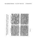 Notch-based fusion proteins and uses thereof diagram and image