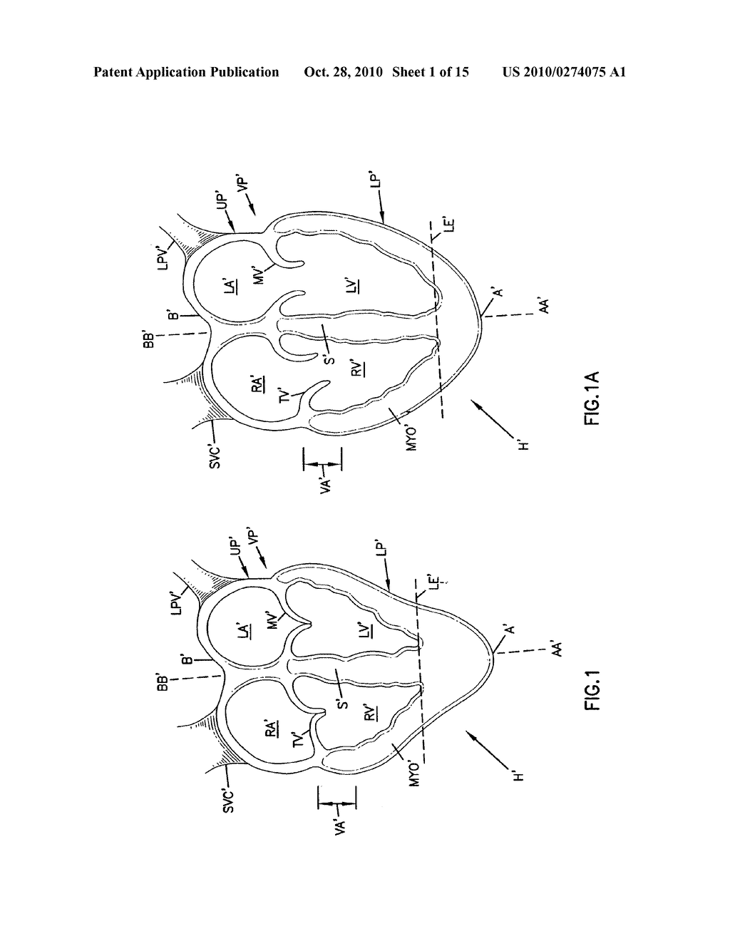 CARDIAC SUPPORT DEVICE - diagram, schematic, and image 02