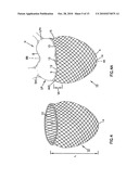 CARDIAC SUPPORT DEVICE diagram and image