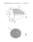 CARDIAC SUPPORT DEVICE diagram and image