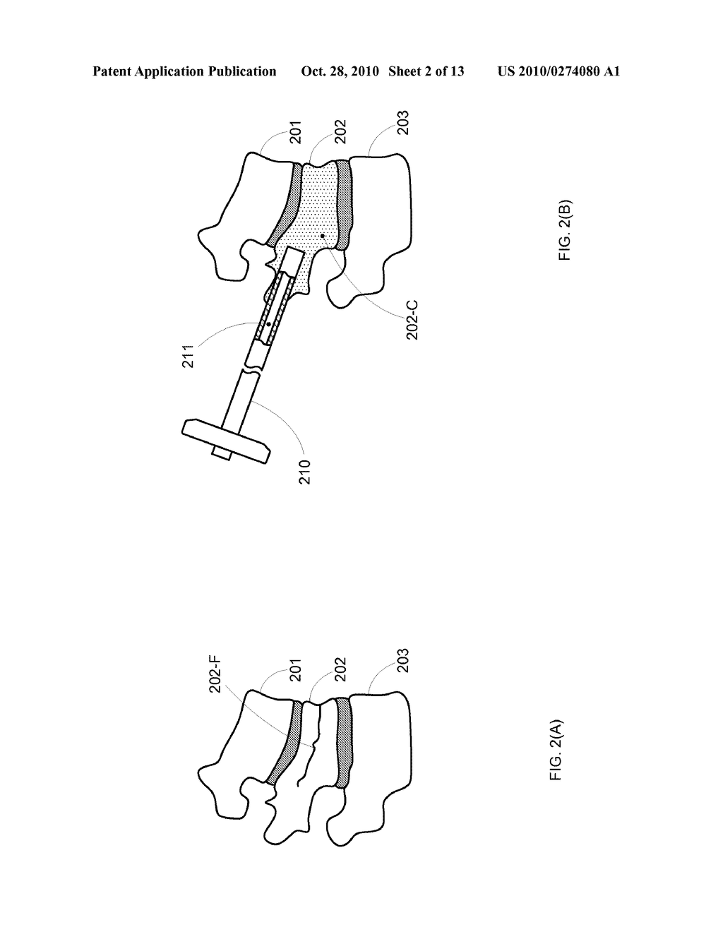 Remote Position Control For Surgical Apparatus - diagram, schematic, and image 03