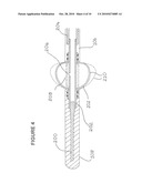 EXCHANGEABLE GUIDE-WIRE WITH BALLOON FOR FOREIGN BODY EXTRACTION diagram and image