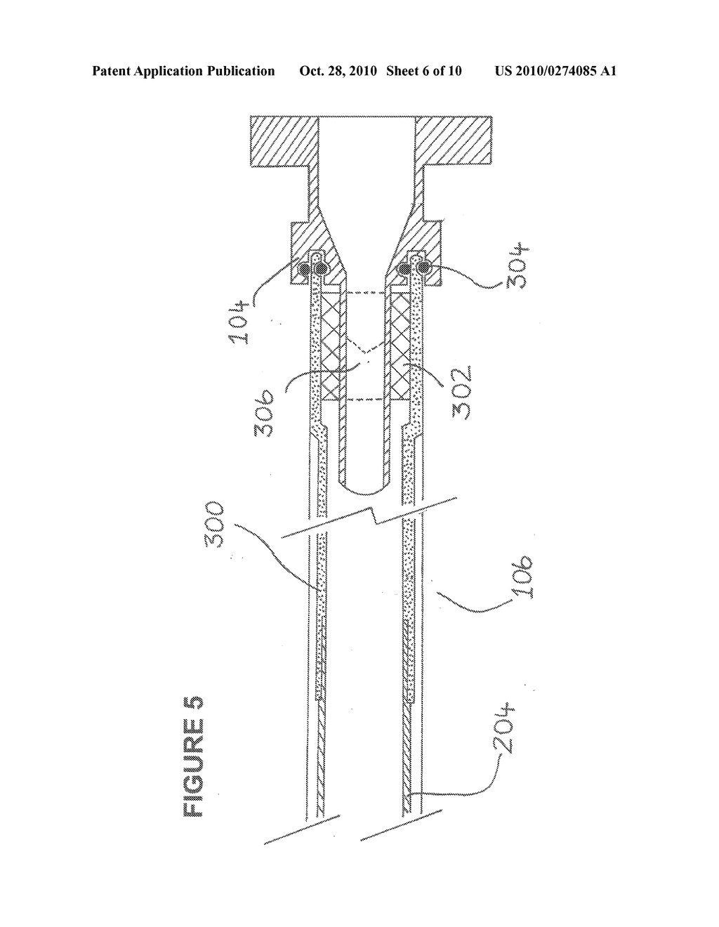 EXCHANGEABLE GUIDE-WIRE WITH BALLOON FOR FOREIGN BODY EXTRACTION - diagram, schematic, and image 07