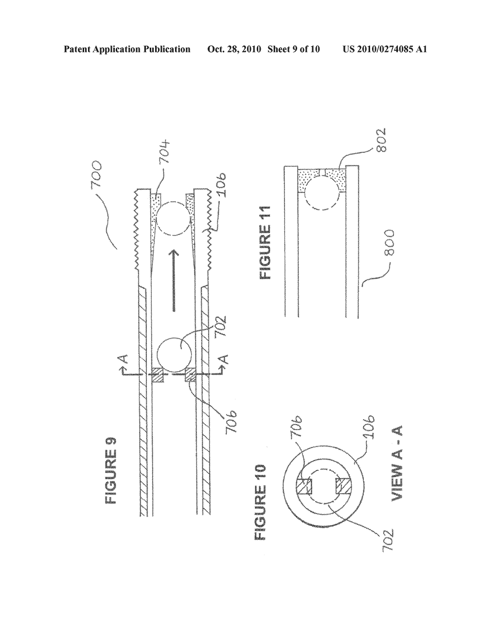 EXCHANGEABLE GUIDE-WIRE WITH BALLOON FOR FOREIGN BODY EXTRACTION - diagram, schematic, and image 10