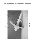 EXPANDING CANNULA AND RETRACTOR DEVICE AND METHODS OF USE diagram and image