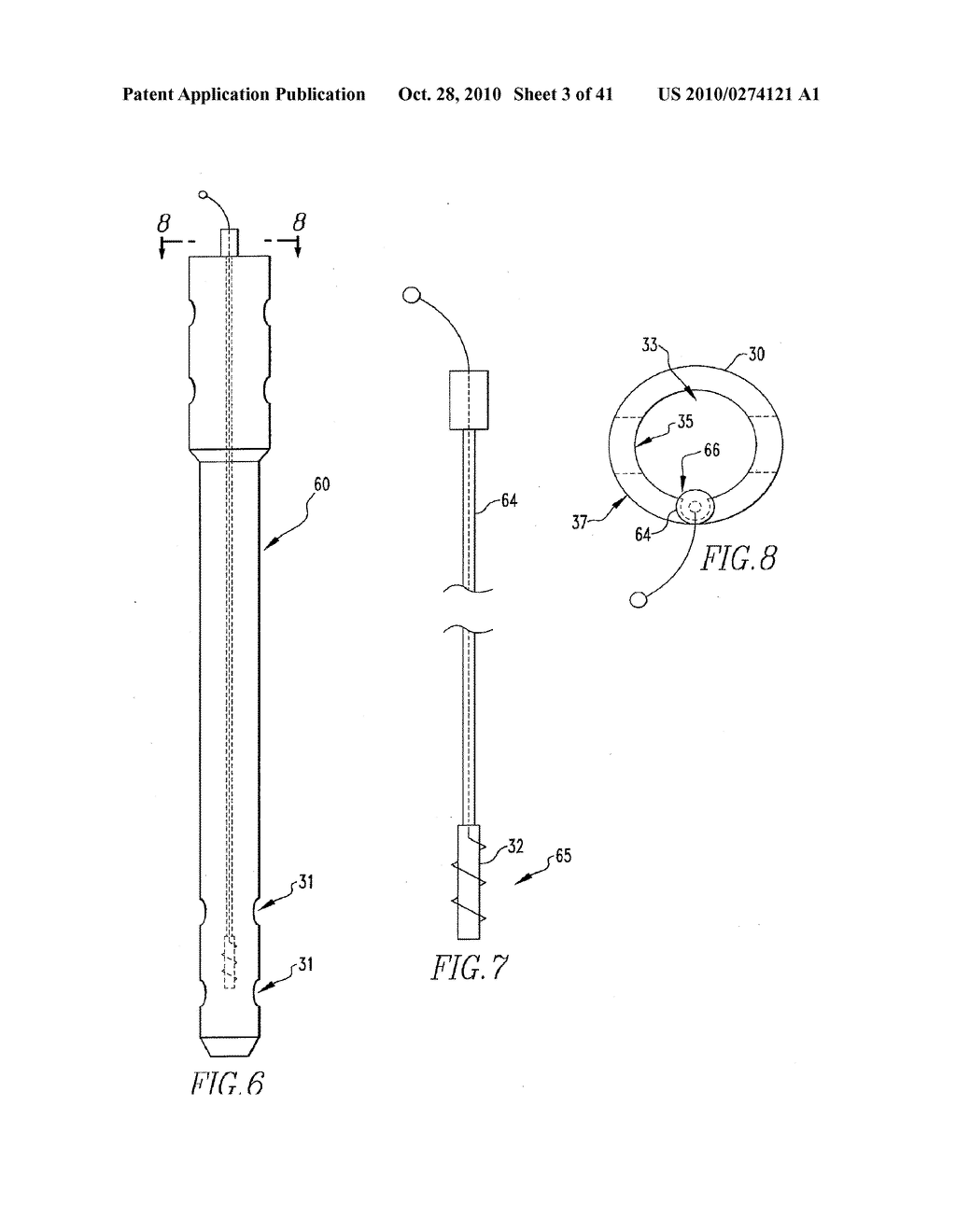 Targeting an orthopaedic implant landmark - diagram, schematic, and image 04