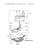 WOUND CLEANSING APPARATUS WITH SCAFFOLD diagram and image