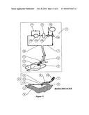 WOUND CLEANSING APPARATUS WITH SCAFFOLD diagram and image