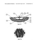 WOUND CLEANSING APPARATUS WITH SCAFFOLD diagram and image