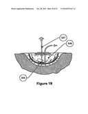 WOUND CLEANSING APPARATUS WITH SCAFFOLD diagram and image