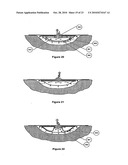 WOUND CLEANSING APPARATUS WITH SCAFFOLD diagram and image