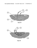 WOUND CLEANSING APPARATUS WITH SCAFFOLD diagram and image