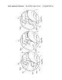 Medicine Dispensing Device diagram and image