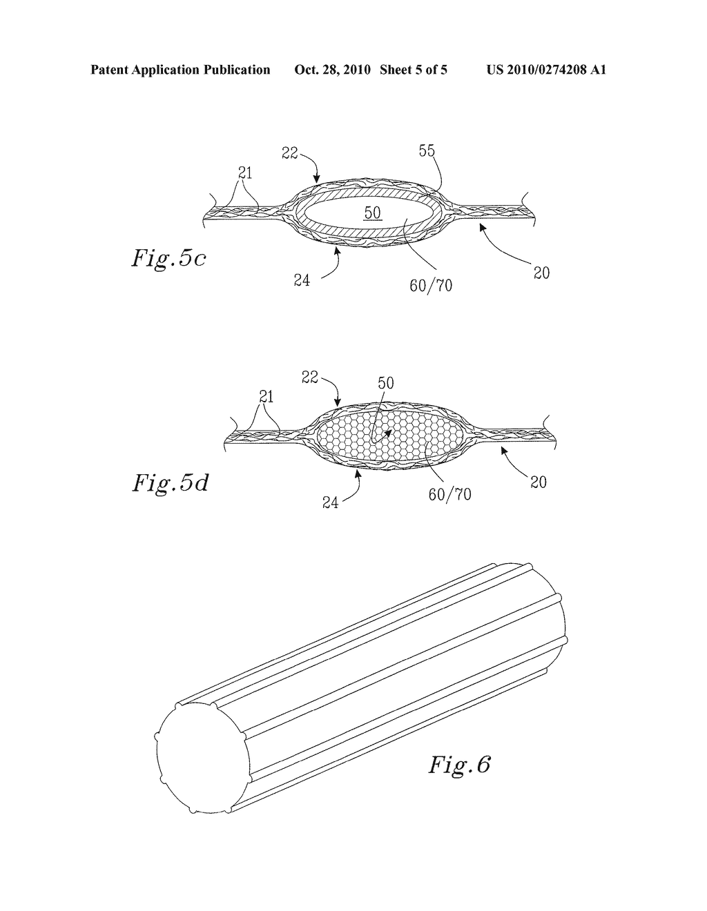 ABSORBENT ARTICLE WITH VENTILATED TOPSHEET - diagram, schematic, and image 06