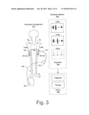 ACQUIRING NERVE ACTIVITY FROM CAROTID BODY AND/OR SINUS diagram and image