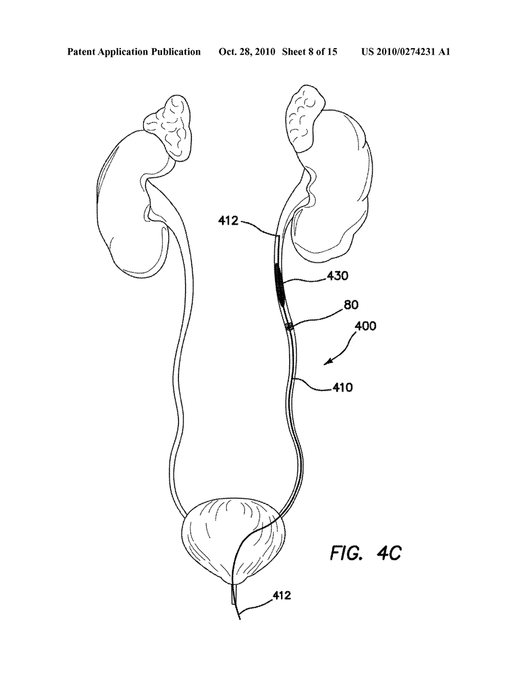 RENAL FLUSHING CATHETER - diagram, schematic, and image 09