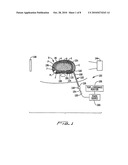 Apparatus and Method for Treatment of an Intervertebral Disc diagram and image