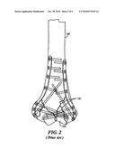 Fracture fixation system diagram and image