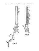 Fracture fixation system diagram and image