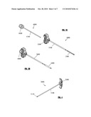 EXPANDABLE INTRAMEDULLARY NAIL FOR SMALL BONE FIXATION diagram and image