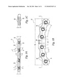 Bone Plate diagram and image