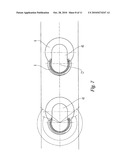 Bone Plate diagram and image