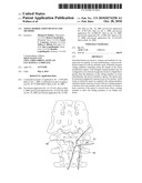 TISSUE MODIFICATION DEVICES AND METHODS diagram and image