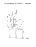 TISSUE MODIFICATION DEVICES AND METHODS diagram and image