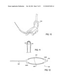 TISSUE MODIFICATION DEVICES AND METHODS diagram and image