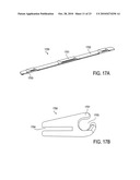 TISSUE MODIFICATION DEVICES AND METHODS diagram and image