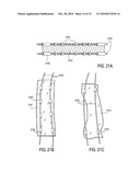 TISSUE MODIFICATION DEVICES AND METHODS diagram and image