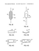 TISSUE MODIFICATION DEVICES AND METHODS diagram and image