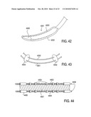 TISSUE MODIFICATION DEVICES AND METHODS diagram and image