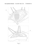 Instruments for Carrying Out an Operating Procedure on a Joint diagram and image