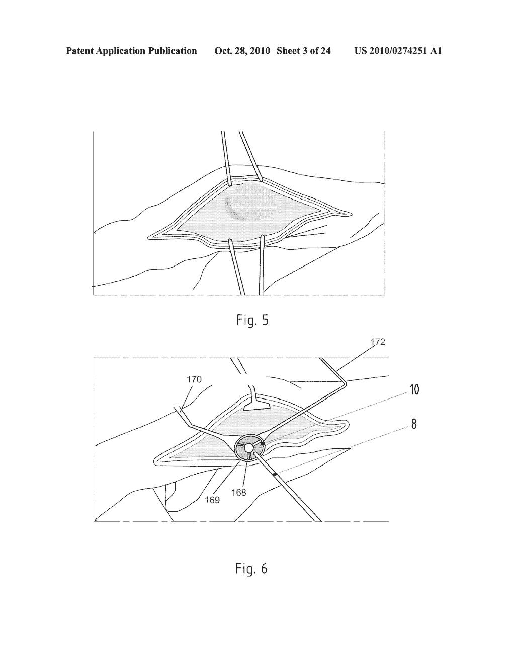 Instruments for Carrying Out an Operating Procedure on a Joint - diagram, schematic, and image 04