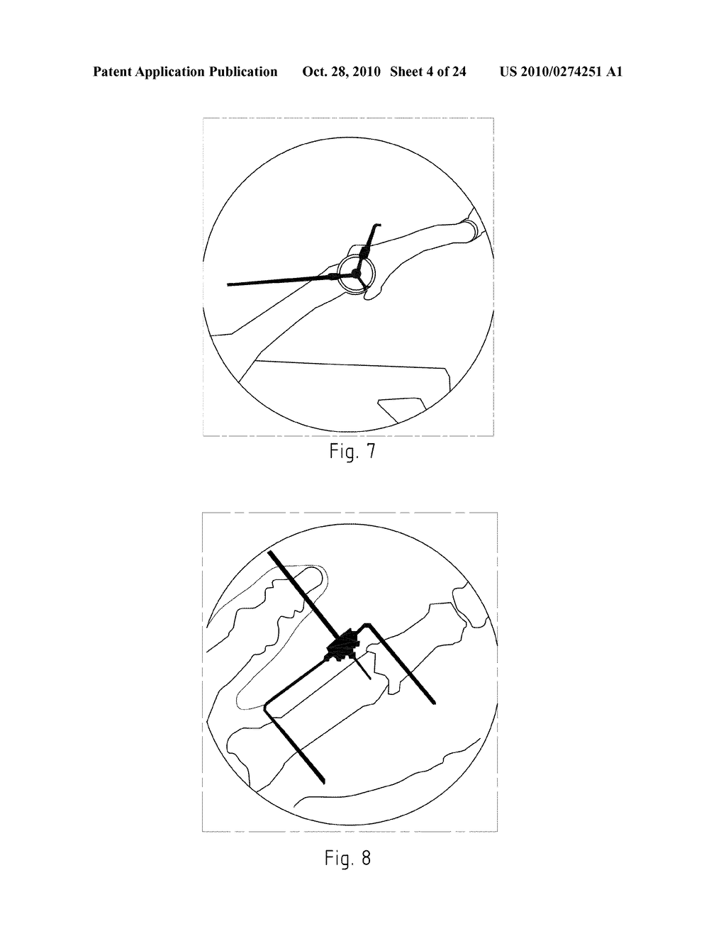 Instruments for Carrying Out an Operating Procedure on a Joint - diagram, schematic, and image 05