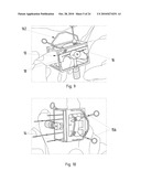 Instruments for Carrying Out an Operating Procedure on a Joint diagram and image