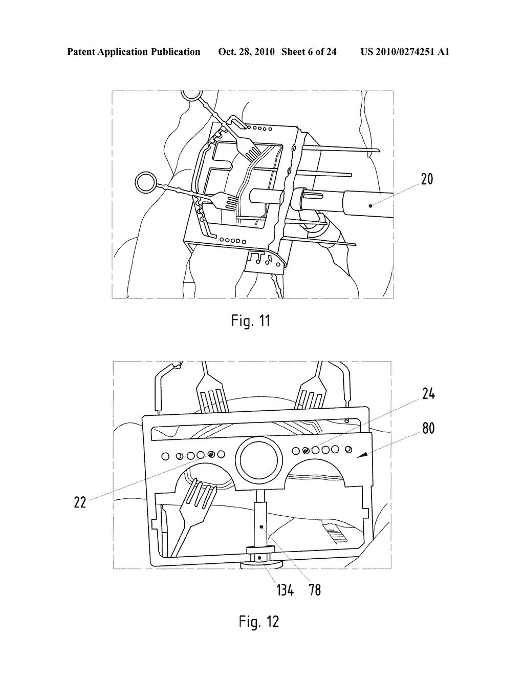 Instruments for Carrying Out an Operating Procedure on a Joint - diagram, schematic, and image 07