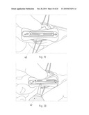 Instruments for Carrying Out an Operating Procedure on a Joint diagram and image