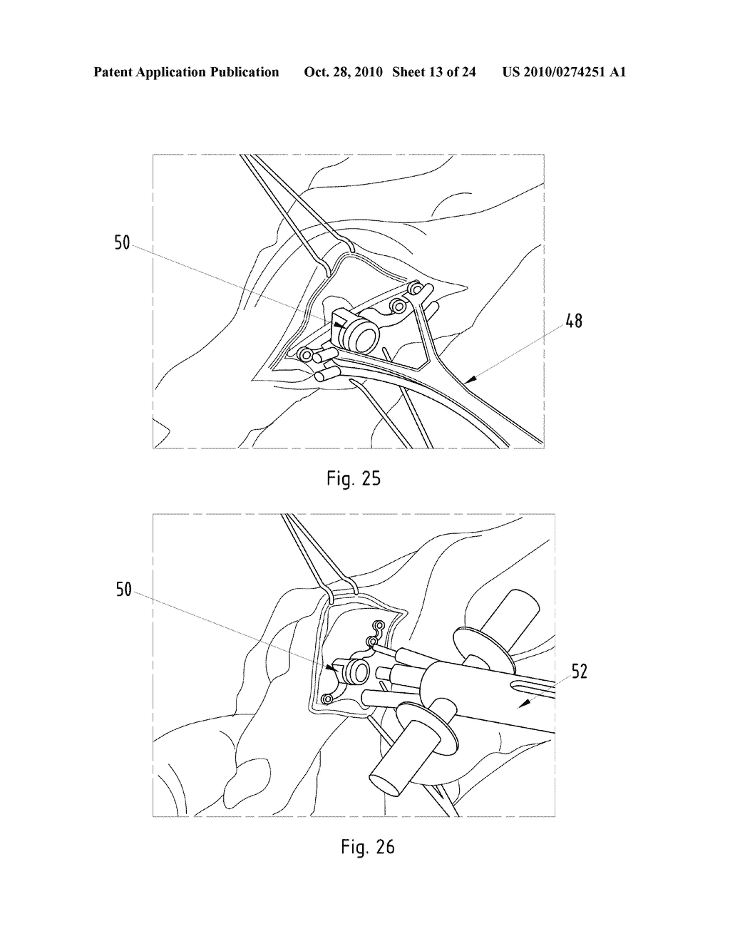 Instruments for Carrying Out an Operating Procedure on a Joint - diagram, schematic, and image 14