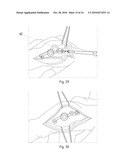 Instruments for Carrying Out an Operating Procedure on a Joint diagram and image