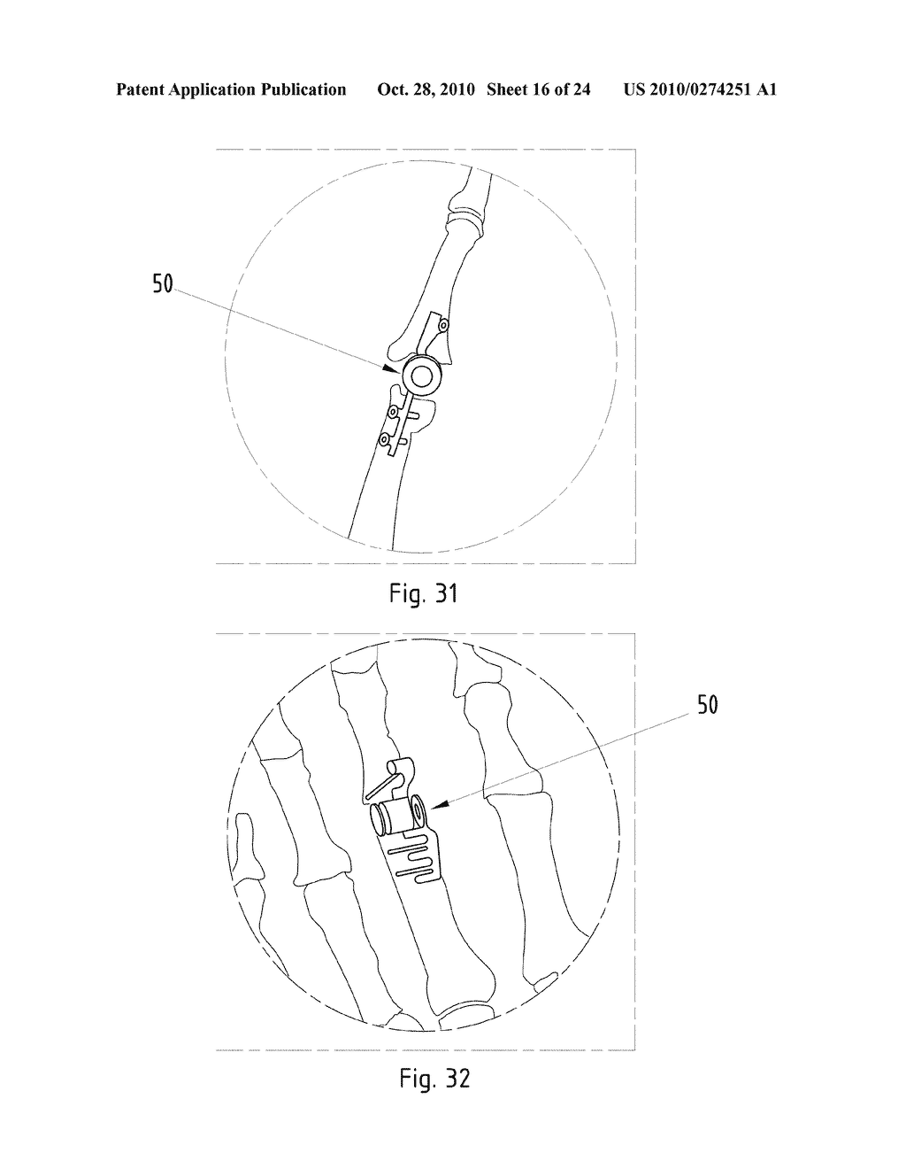 Instruments for Carrying Out an Operating Procedure on a Joint - diagram, schematic, and image 17