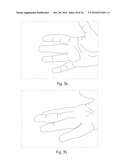 Instruments for Carrying Out an Operating Procedure on a Joint diagram and image