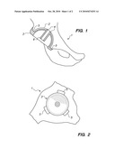 Device and method for achieving accurate positioning of acetabular cup during total hip replacement diagram and image