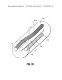 FLEXIBLE ENDOSCOPIC STITCHING DEVICES diagram and image