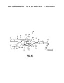 FLEXIBLE ENDOSCOPIC STITCHING DEVICES diagram and image