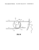 FLEXIBLE ENDOSCOPIC STITCHING DEVICES diagram and image